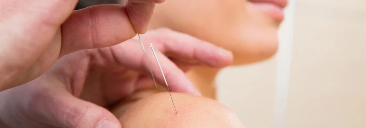 Neuropathy Carroll IA Acupuncture